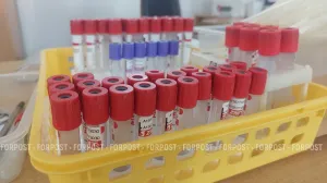 В 2026 году на расширенный забор крови у младенцев выделено 72 миллиона рублей.