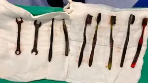 В Индии врачи спасли мужчину, который наглотался зубных щёток