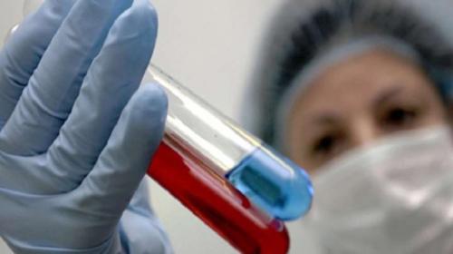 ForPost - В России резко выросло число связанных с ВИЧ заболеваний