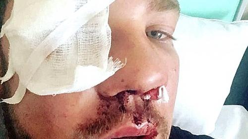 ForPost - Бастрыкин наградил парня, которого жестоко избили в метро