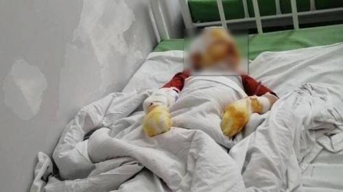 ForPost- Стало известно о состоянии подожжённого отцом малыша из Крыма 