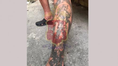 ForPost- В Севастополе турист пообещал полиции заменить нацистское тату на серп и молот