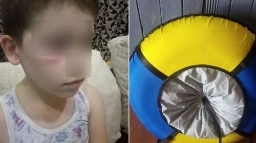 ForPost- 9-летнего мальчика избили за жёлто-синюю «ватрушку»