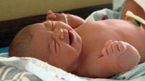 ForPost - Севастопольский «Центр охраны здоровья матери и ребенка» получил новое оборудование