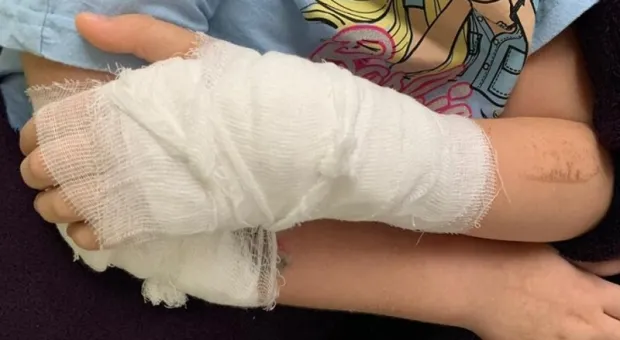 «Извините, не посмотрел снимки»: ребёнку в Калининграде прооперировали не ту руку
