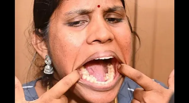 Жительница Индии стала самой зубастой женщиной мира
