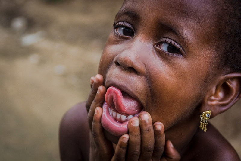 Коронавирус: почему Африка лучше знает