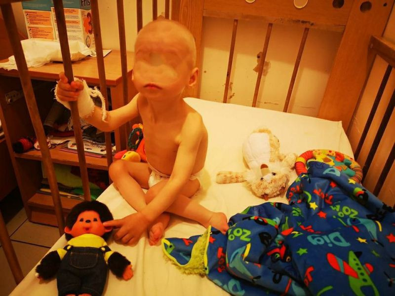 ForPost - Новости : Истощенному малышу из Крыма потребуется операция