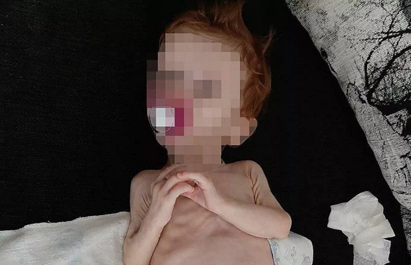 ForPost - Новости : Жившую полгода в шкафу новорождённую спас брат