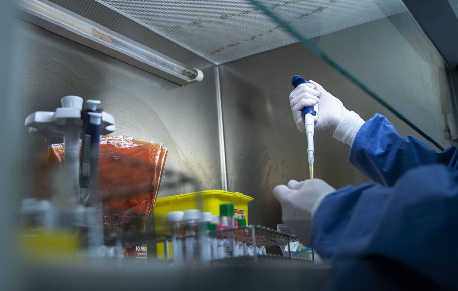 ForPost - Новости : Достоверность популярного теста на коронавирус подвергли сомнению