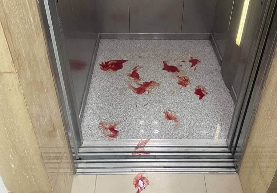 ForPost - Новости : Кровавая драка произошла в спа-центре Севастополя