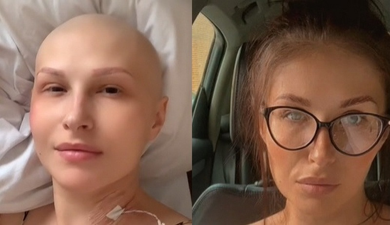 ForPost - Новости : Онкобольная мама трёх дочек рассказала о первом признаке рака
