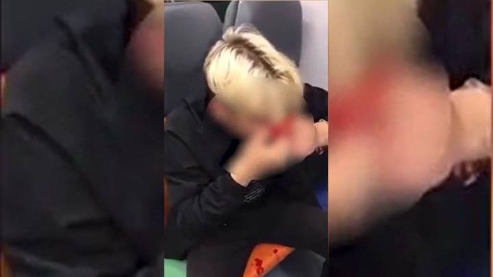 ForPost - Новости : Мужчина избил подростков-неформалов за серьги в непривычных местах