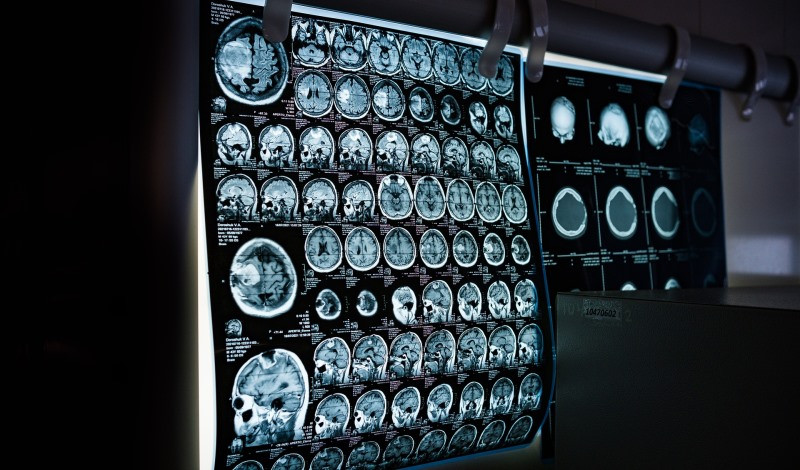 ForPost - Новости : В больницах Севастополя заработает искусственный интеллект