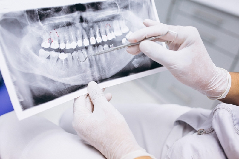 ForPost - Новости : Зубы на полку или в кредит: что будет с ценами на «дентальное здоровье»