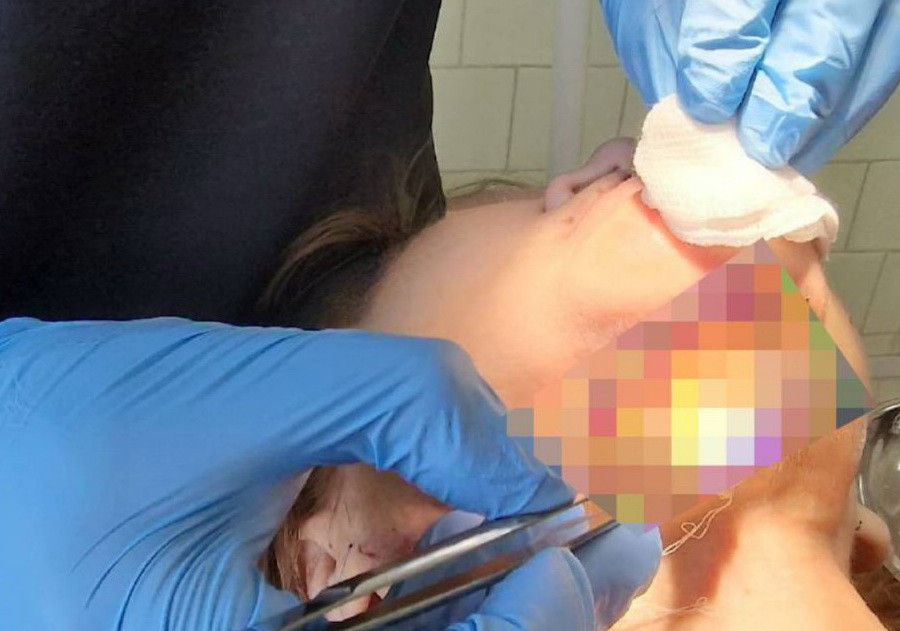 ForPost - Новости : У женщины, боявшейся стоматологов, отмерла и вывалилась челюсть