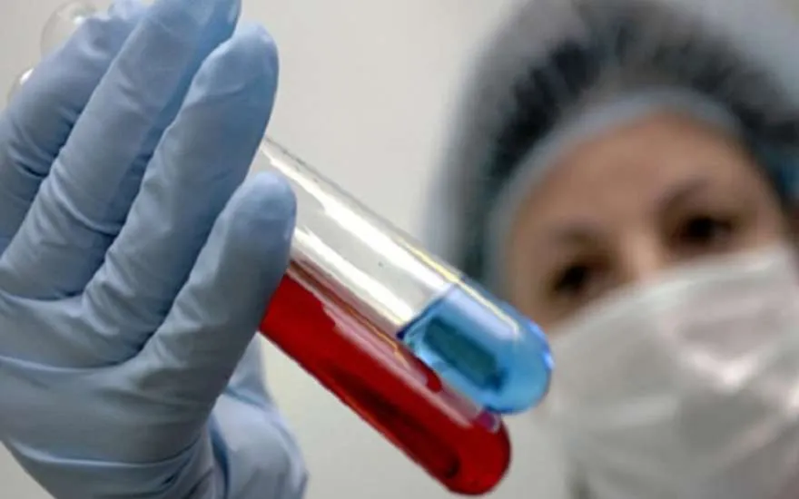 В России резко выросло число связанных с ВИЧ заболеваний