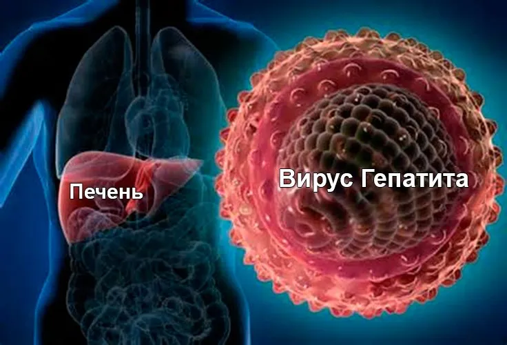 В России произошел скачок заболевания острым гепатитом А