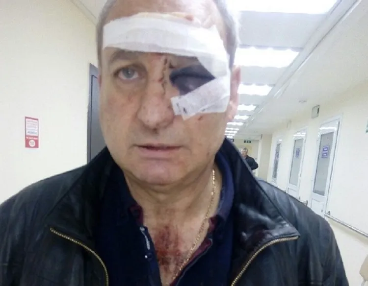 Евпаторийского чиновника обвинили в нападении на горожан