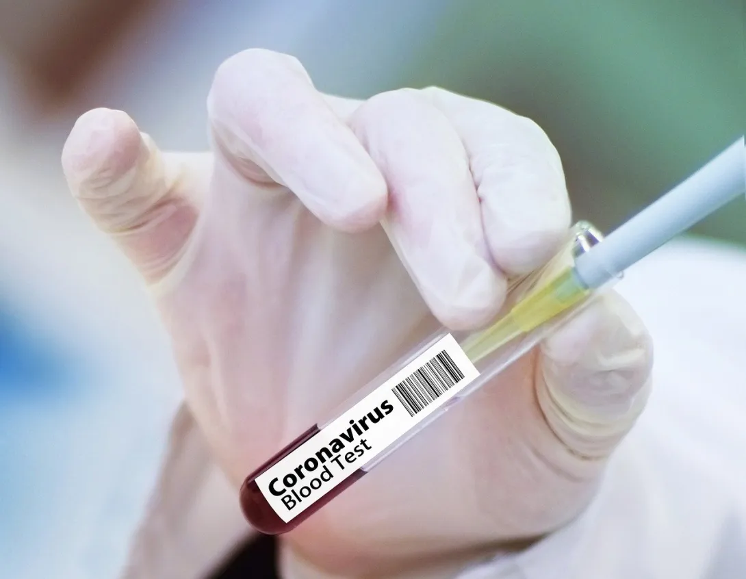 Проходить тест на коронавирус всем севастопольцам не нужно, — Кулагин