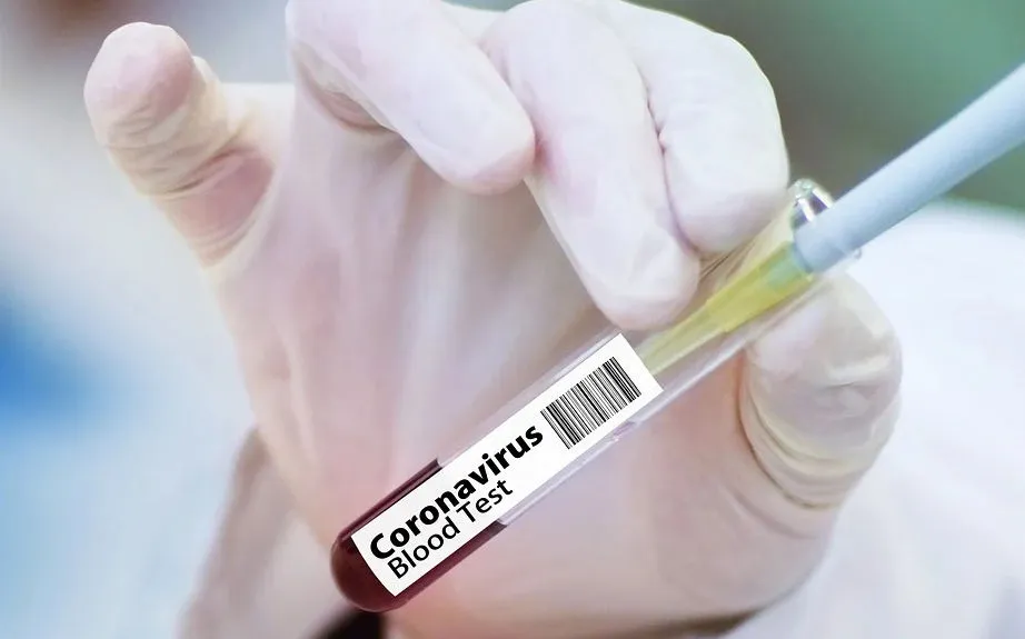 Три новых случая опасного коронавируса выявлено в Севастополе