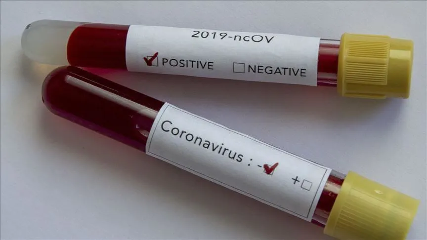 Еще 37 случаев коронавируса выявлено за сутки в Крыму