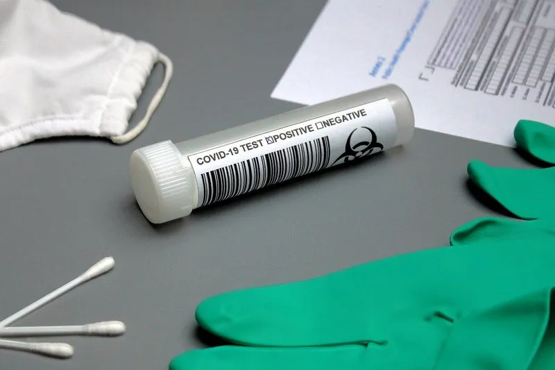 В России установили предельный срок выполнения тестов на коронавирус