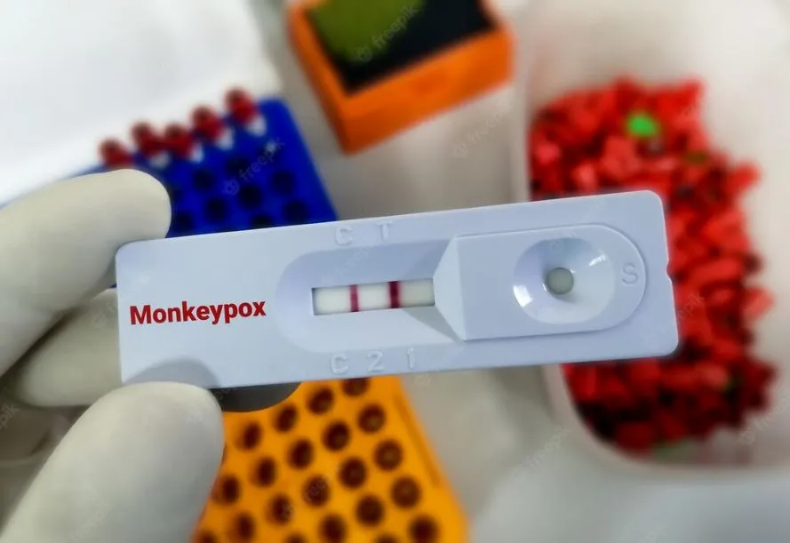 Российских врачей экстренно обучают диагностике оспы обезьян