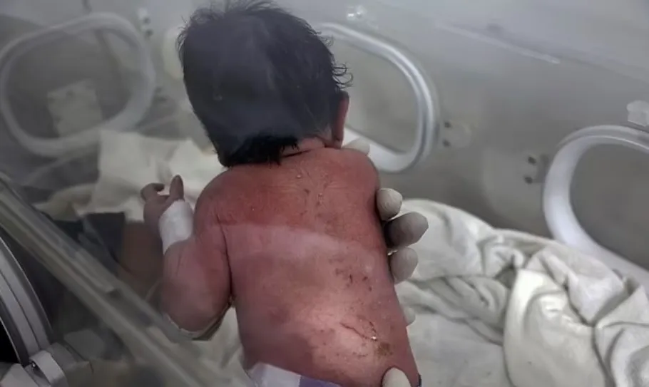 Стали известны подробности о девочке, родившейся под завалами в Сирии