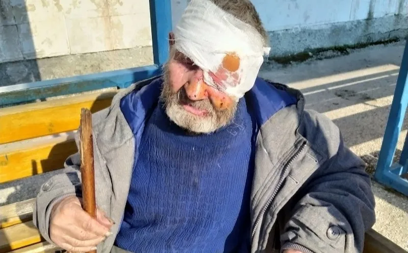 Крым не без добрых людей: как крымчане спасли живущего на пожарище старика