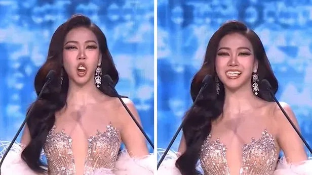 Участница конкурса «Мисс Таиланд» потеряла зубы на сцене, но не растерялась